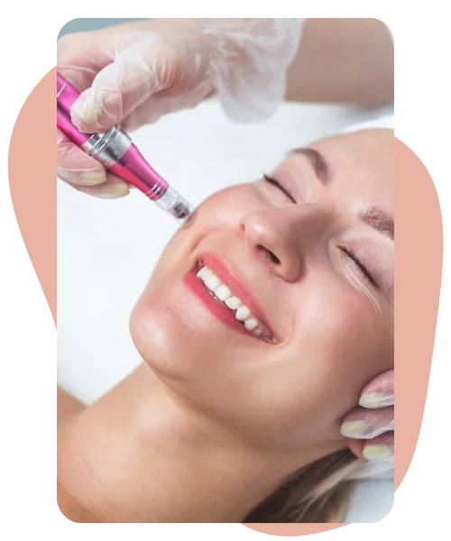 Microneedling – Dermapen